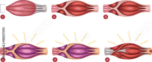 Human Muscle Fiber Contraction Stages Diagram showing Anatomy of Tissue with Six Numbered Steps for Medical Education and Biological Study