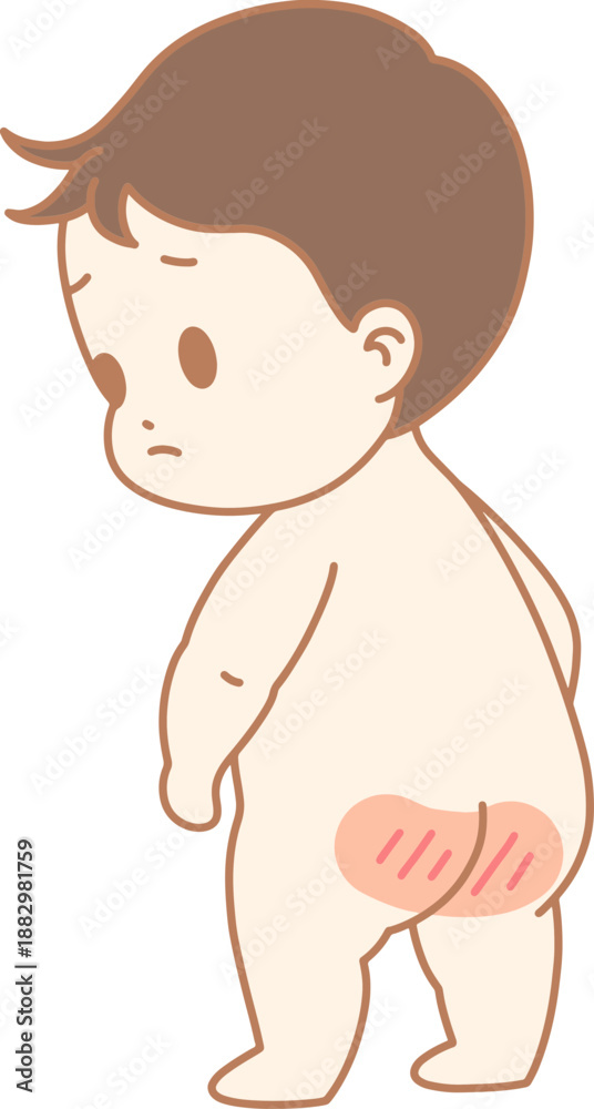 Obraz premium 땀띠