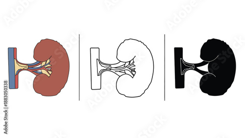 Anatomical illustrations of a human kidney in different visual styles and colors