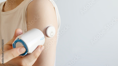 Tableau sur toile Applying Continuous Glucose Monitor Sensor on Arm with Applicator