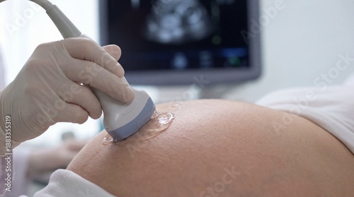 Woman Receives Prenatal Ultrasound in Medical Office During Examination for Fetal Health and Development
