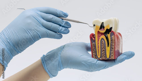 Photos Dental Tooth Anatomy Model With Probe