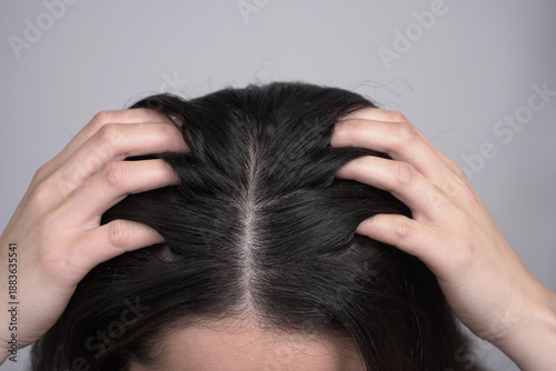 Tableau sur toile A close-up view of a person using both hands to massage their scalp or examine their hair part
