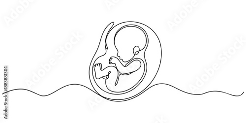 Baby embryo in womb one line drawing. Cute unborn fetus baby on mother womb isolated on white background, Baby embryo in womb in one continuous line drawing. Healthy pregnancy and premature symbol.