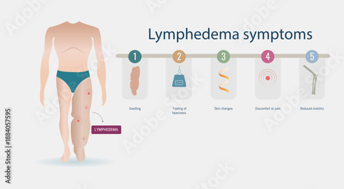 Lymphedema symptoms infographic