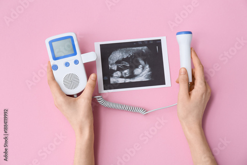 Quadro em tela Female hands with fetal doppler and sonogram image on pink background