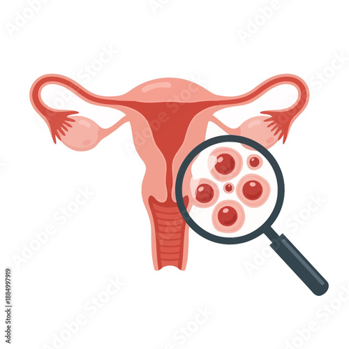 Female reproductive system anatomy with magnified view of ovaries and ova illustration on white background