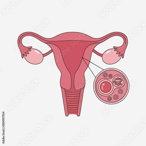 Uterus anatomy with ovaries and fallopian tubes, close-up of ovum and follicles