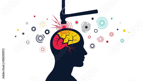 An abstract and dramatic illustration of a hammer hitting a person's cracked head, graphically representing a severe headache or mental breakdown.