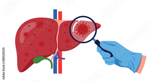 Doctor's gloved hand using a magnifying glass to examine a human liver infected with the hepatitis virus for diagnosis.