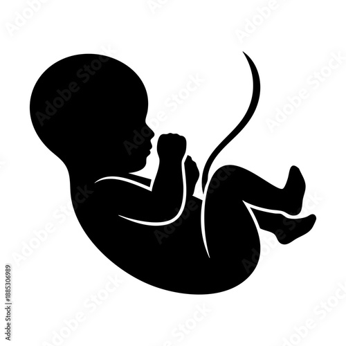 Silhouette of a fetus in a gestational position