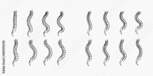 Human spine anatomy with various curvatures and conditions, vector illustration for medical and educational purposes.