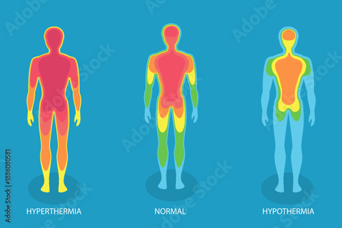 3D Isometric Flat Vector Illustration of Human Body Temperature, Hyperthermia And Hypothermia