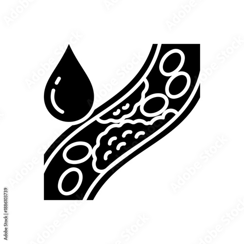 Hyperlipidemia related to metabolic syndrome medical concept