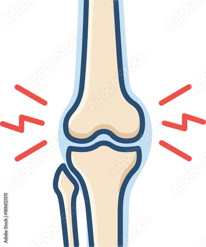 Human knee joint pain vector illustration indicating arthritis, injury, or inflammation.