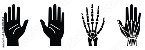 Anatomy of hand and skeletal system in medical diagram depicting metacarpals and phalanges bone structure
