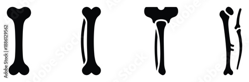 Human elbow with joint bone structure anatomy for medical education science graphic design medicine