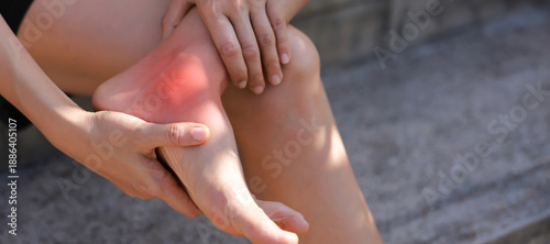 Tableau sur toile Close-up of woman hand holding painful injured ankle with red inflamed spot and bruising
