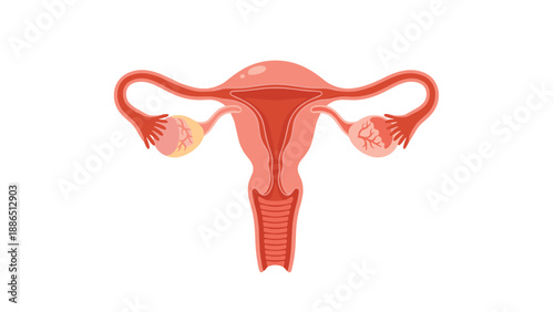 Anatomical illustration of the female reproductive system, including the uterus, ovaries, and fallopian tubes, for medical and educational use.