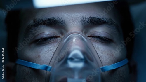 Close-up of a patient wearing an oxygen mask in a dimly lit hospital bed. Over eight seconds, the patient's eyes flicker open and closed, reflecting a struggle with critical or fluctuating consciousn