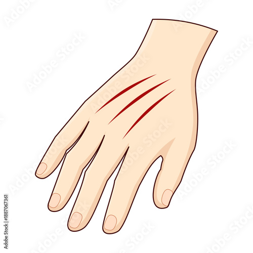Illustration of a human hand with minor scratch wounds on the skin. Simple flat style with transparent background, suitable for medical, health, or first aid concepts