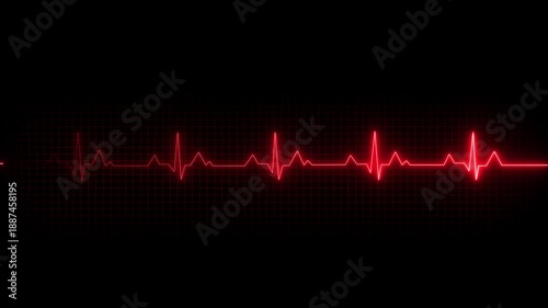 EKG Heartbeat reading animation on black background. Medical monitor displaying cardiography pulse checkup diagnosis electronic screen display machine. Motion graphics of pulse line concept