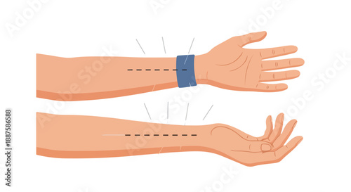 Acupuncture Points on Human Arm and Wrist for Pain Relief