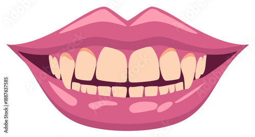Illustration of pink lips with teeth in an open smile expression.