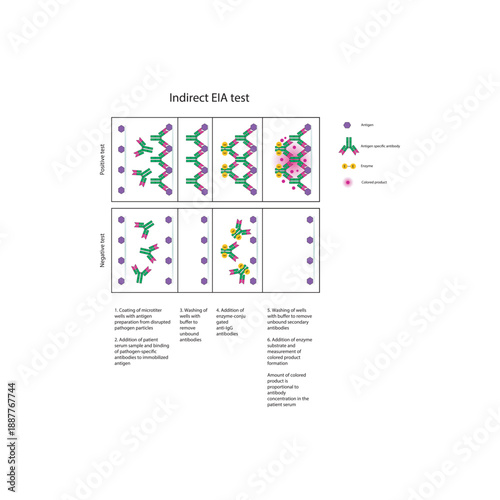 Indirect EIA (ELISA) test diagram illustrating antibody detection, enzyme-linked secondary antibodies, colorimetric signal, and quantitative immune response diagram