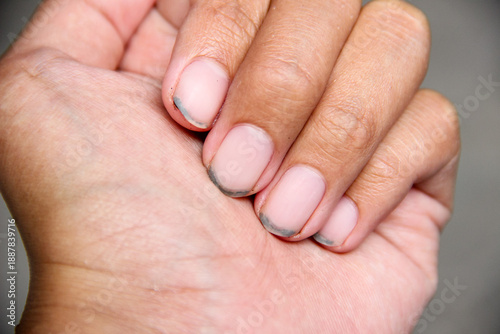 Close up of dirt that accumulates under fingernails. Hand care. Personal hygiene