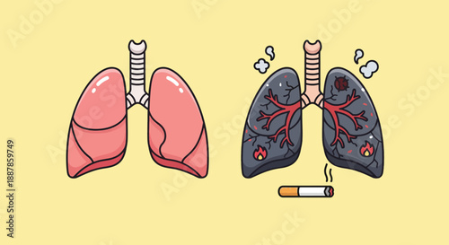 Healthy Lungs vs Lungs Damaged by Smoking Comparison.