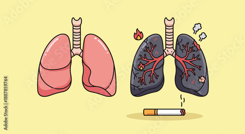 Healthy Lungs Versus Lungs Damaged by Smoking.