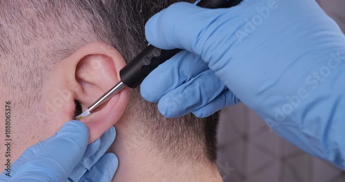 Close-up of a doctor removing earwax from a male patient’s ear using a medical instrument. ENT care, hygiene, and professional healthcare procedure concept.
