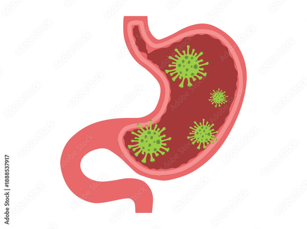 Fototapeta premium Stomach Infection Bacteria Virus