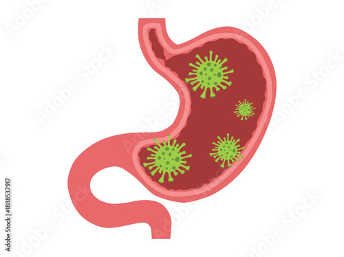 Stomach Infection Bacteria Virus
