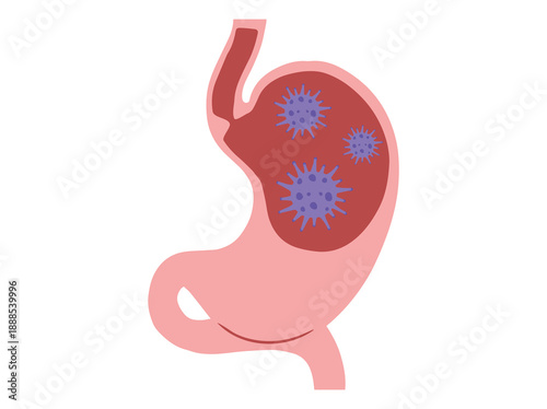 Stomach Infection Bacteria Virus
