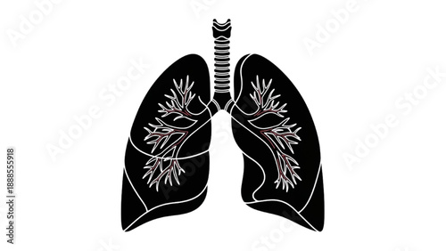 Anatomical illustration of human lungs showing bronchi and airways