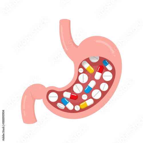 Stomach Filled With Pills and Capsules, Medical Concept Illustration