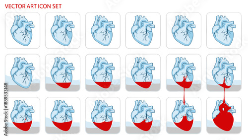 Bleeding Human Heart Vector Art Icon Set Illustrates Progressive Cardiac Distress
