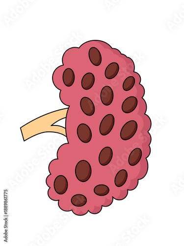 Cartoon Illustration of a Diseased Human Kidney with Cysts or Lesions Isolated on White