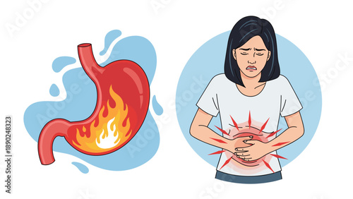 Medical illustration explaining heartburn and acid reflux, showing a woman in pain and a diagram of a stomach with inflammation.