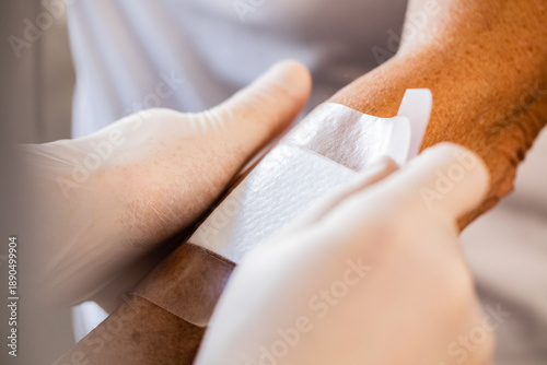 Tableau sur toile A close up of nurses hands with gloves applying a hydrocolloid bandage onto an e
