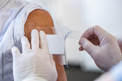 Tableau sur toile A close up of nurses hands with gloves applies a hydrocolloid bandage onto an el