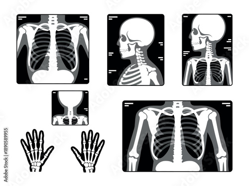 A collection of x-ray images showing the human skeleton from various angles and perspectives.