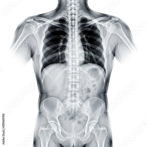 Detailed human torso X-ray showing spine, ribs, lungs, and pelvis. Medical radiography image for healthcare, diagnostics, anatomy education, and medical technology concepts