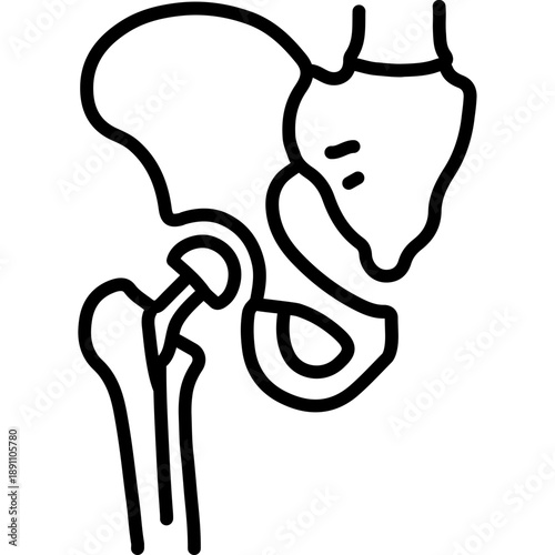 Hysterectomy Vector Icon