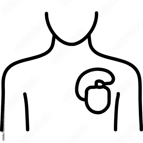 Pacemaker Implantation Vector Icon