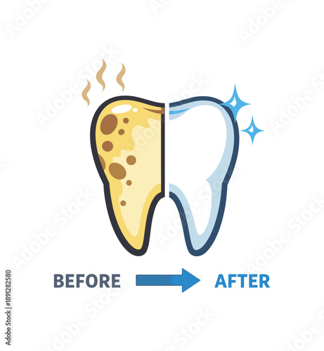 full color flat icon tooth with plaque spots on one side and clean side before after hygiene