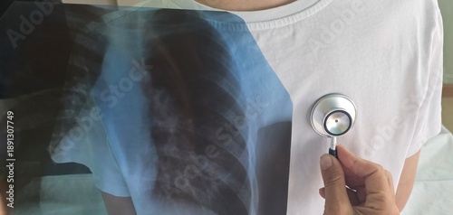 Photos Pediatrician with stethoscope listening to a lungs in child with bronchitis and