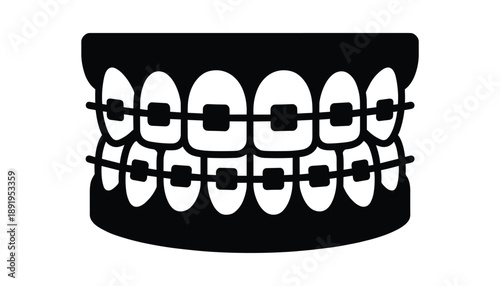 Orthodontics teeth with braces dental care concept healthy gums for perfect smile black silhouette
